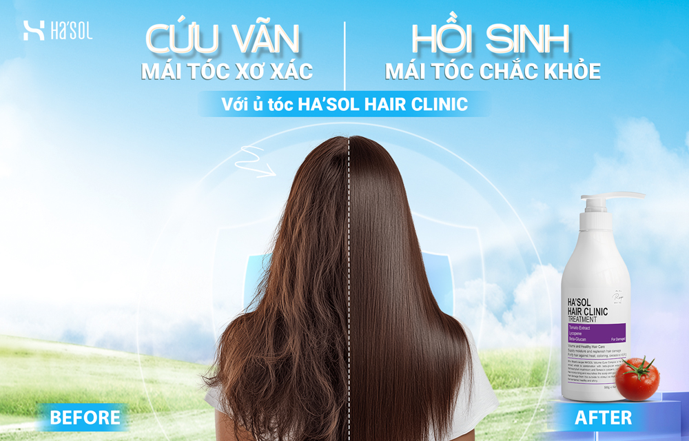 Đừng để mái tóc xơ xác làm giảm phong độ của bạn!